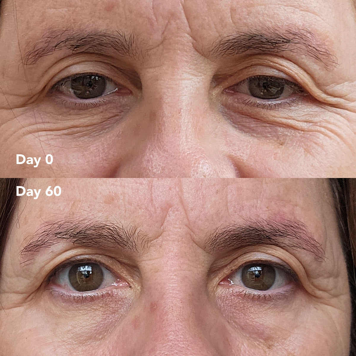 Evie D. before and after