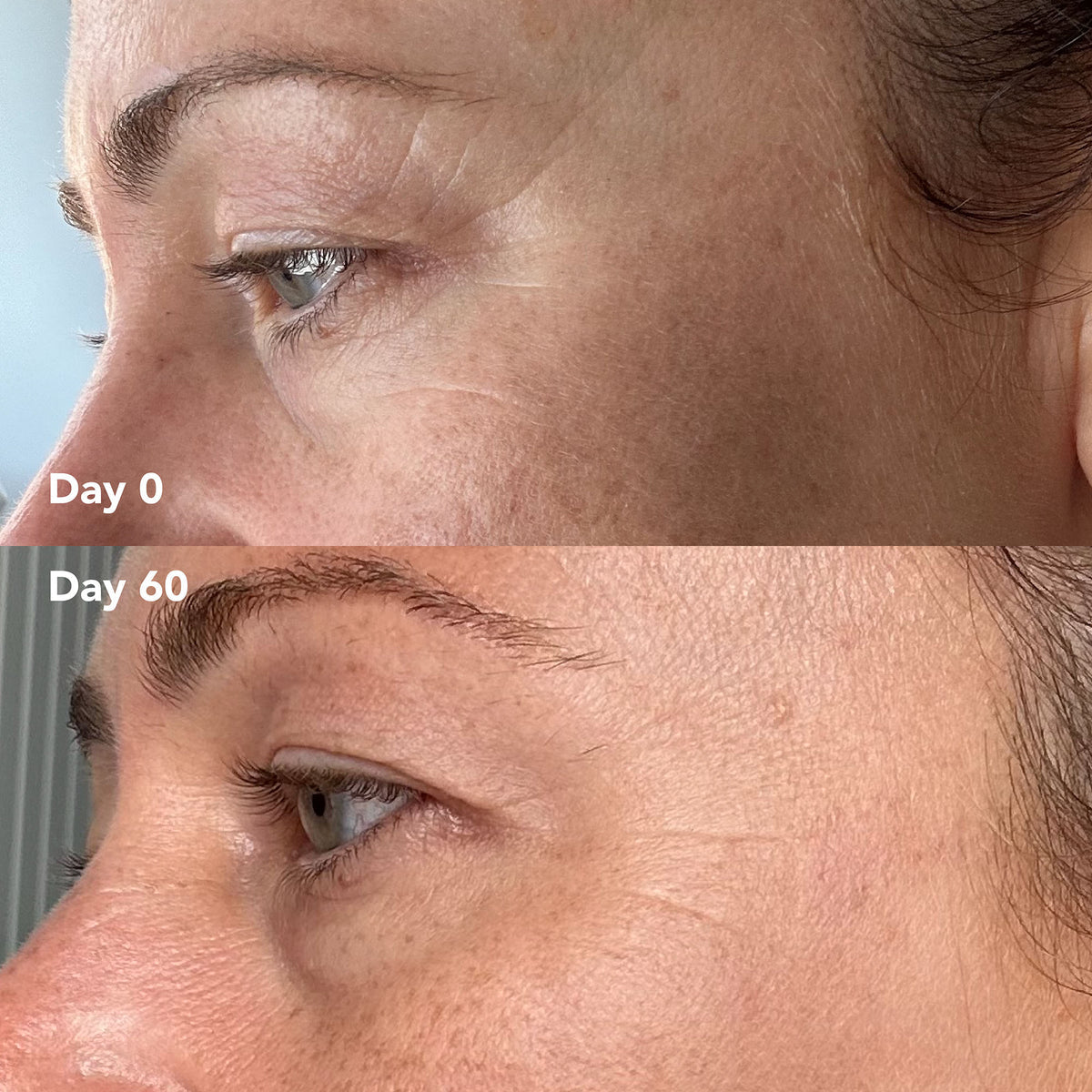 Jodie O. before and after