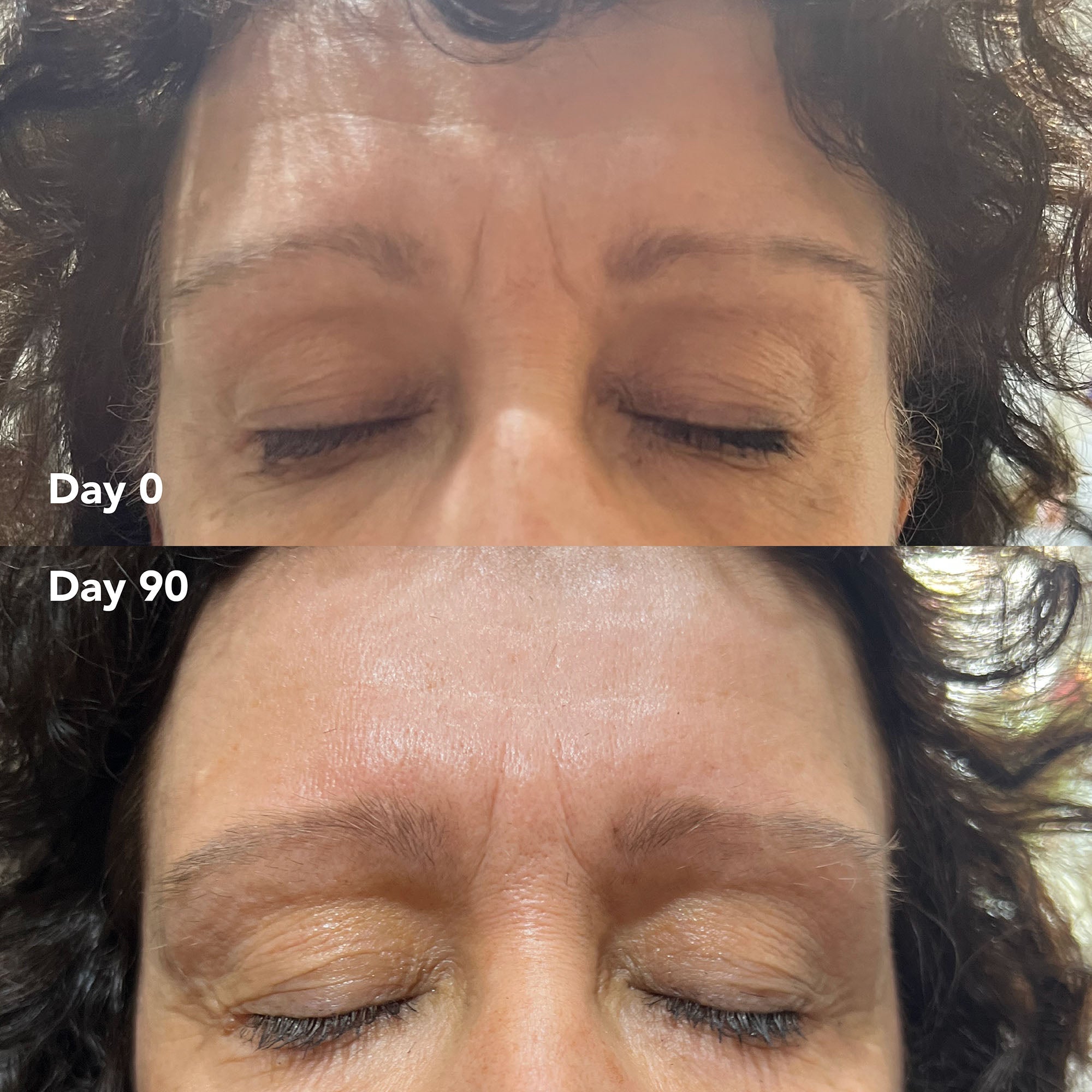 Julie A. before and after