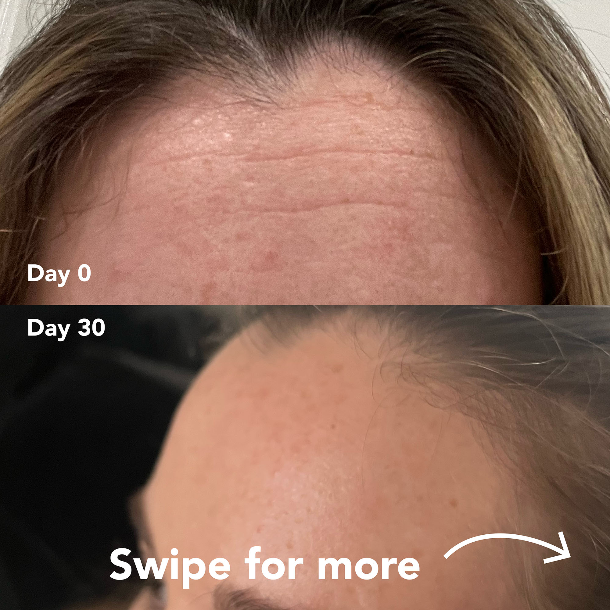 Katie L. before and after