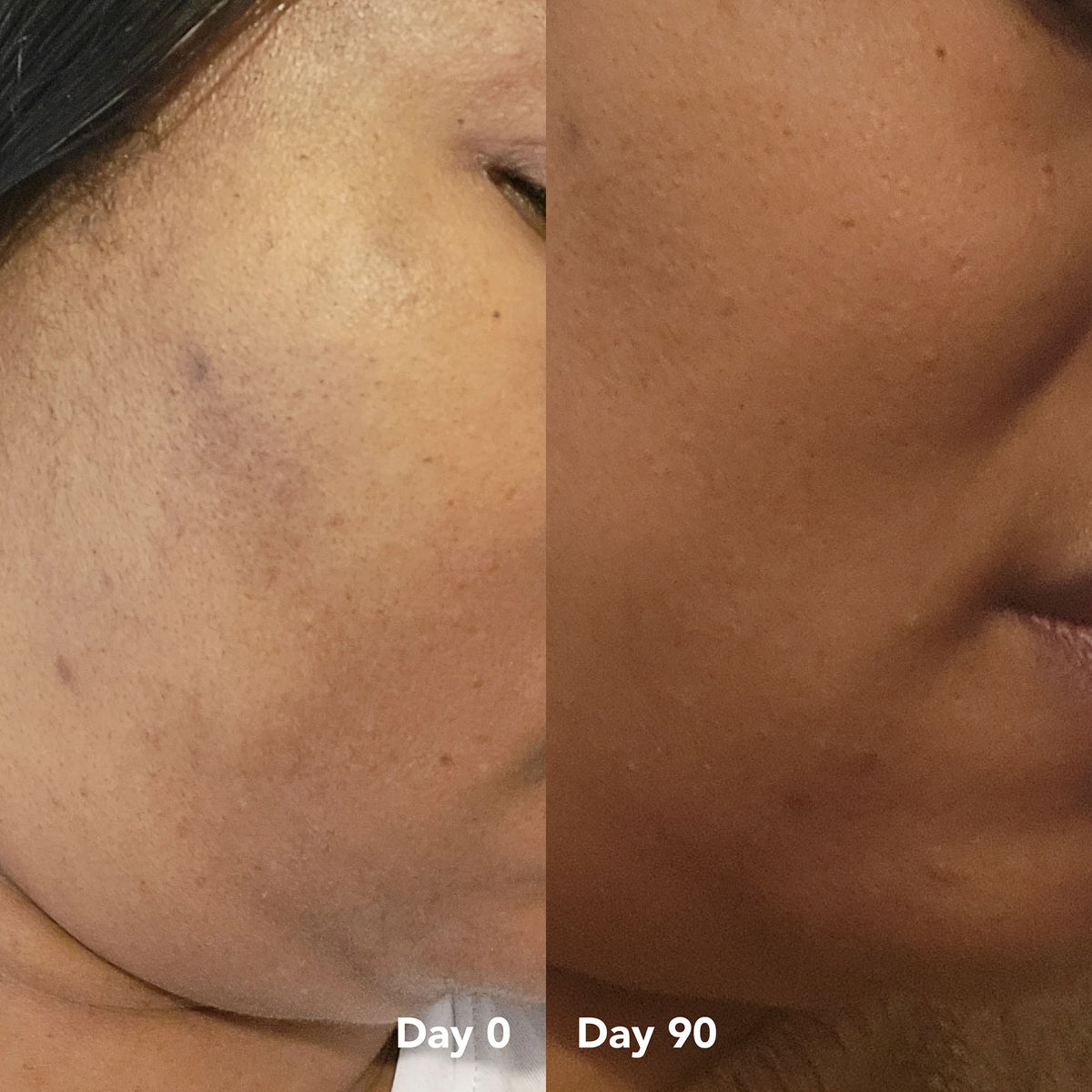 Maureen O. before and after