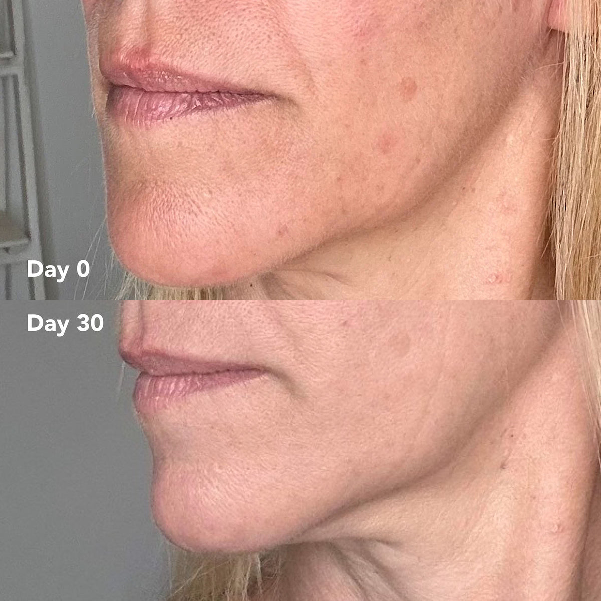 Melanie T. before and after