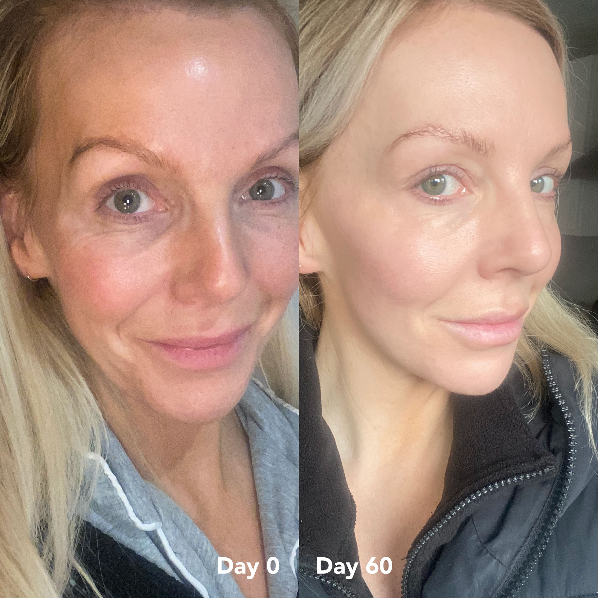 Nicole L. before and after