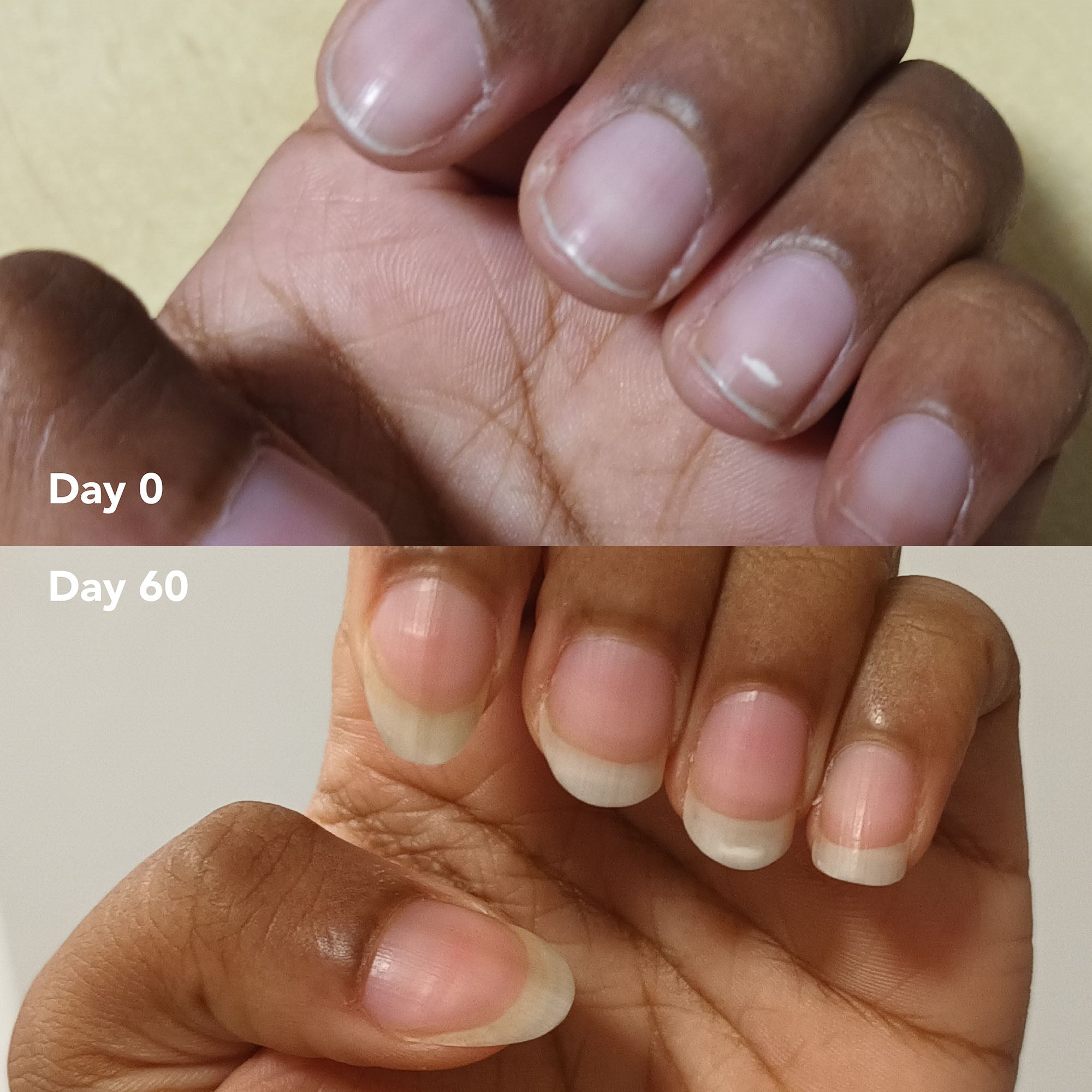 Sinthu S. before and after