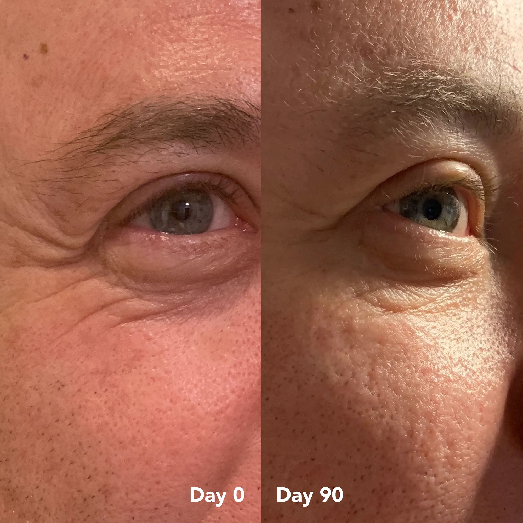 Stephen D. before and after
