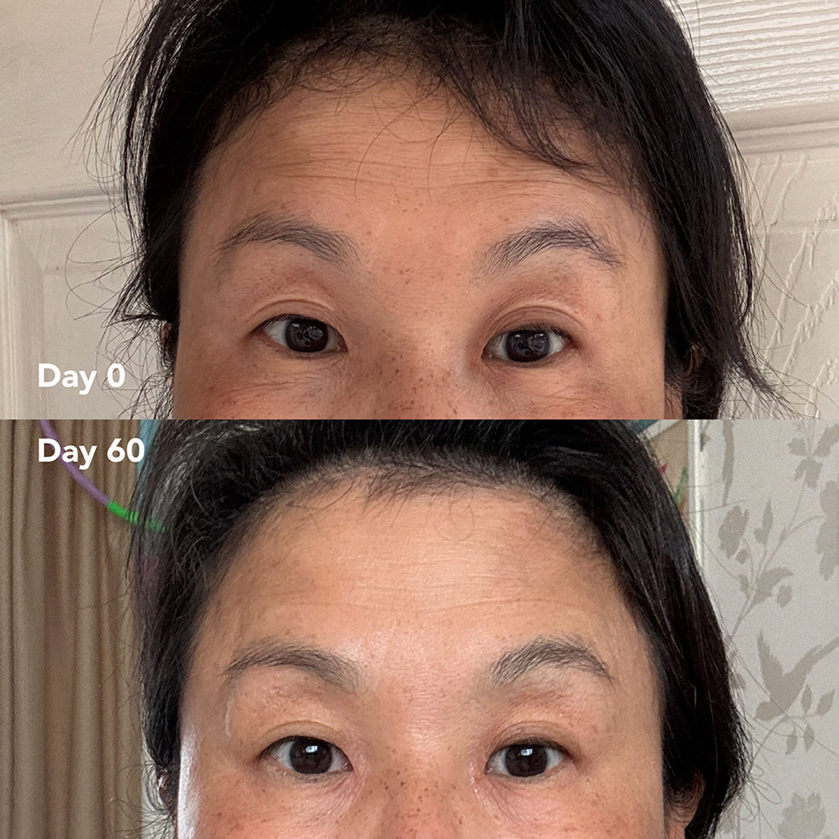 Teresa M. before and after